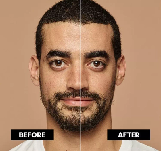 L'Oréal Paris True Match podkład dopasowujący się do koloru skóry 4.5 N 30 ml