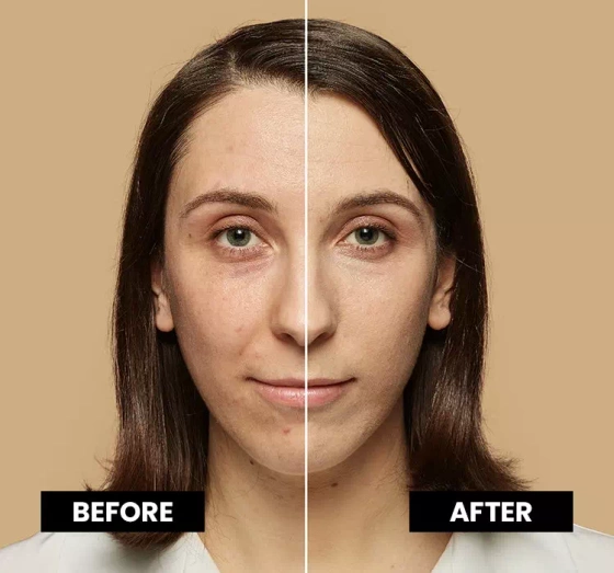 L'Oréal Paris True Match podkład dopasowujący się do koloru skóry 1.5 N 30 ml