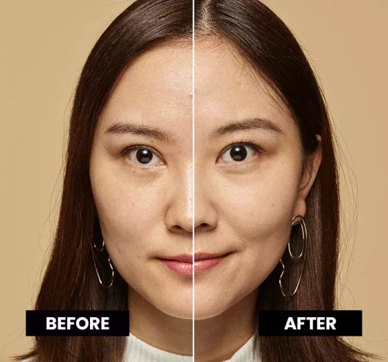 L'Oréal Paris True Match podkład dopasowujący się do koloru skóry 2 N 30 ml