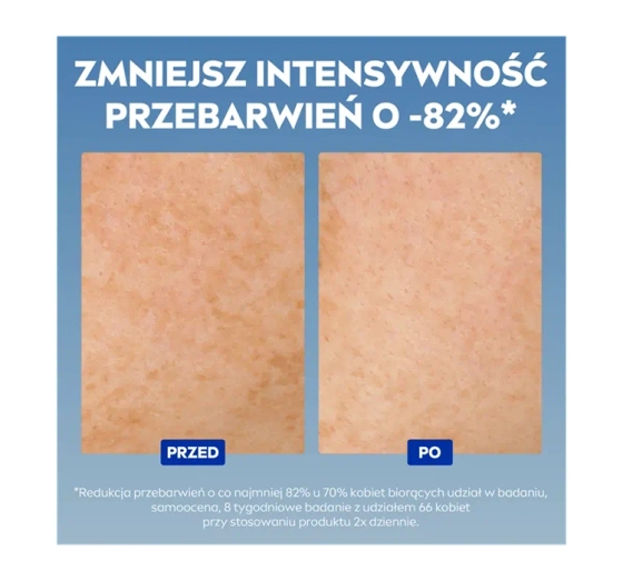 NIVEA Luminous630 intensywne serum przeciw przebarwieniom 30 ml