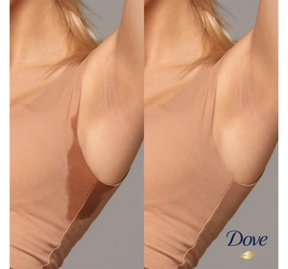 Dove Original Advanced Care antyperspirant roll-on 50 ml