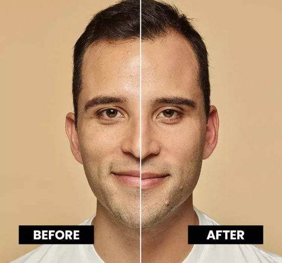 L'Oréal Paris True Match podkład dopasowujący się do koloru skóry 5 N 30 ml